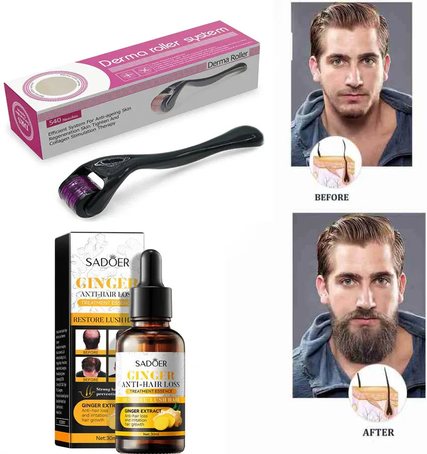 540 Titanium Derma Roller – Microneedling Skin Care Tool for Face, Hair & Beard Growth