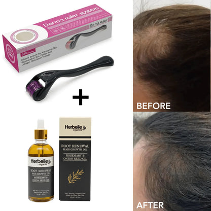 540 Titanium Derma Roller – Microneedling Skin Care Tool for Face, Hair & Beard Growth