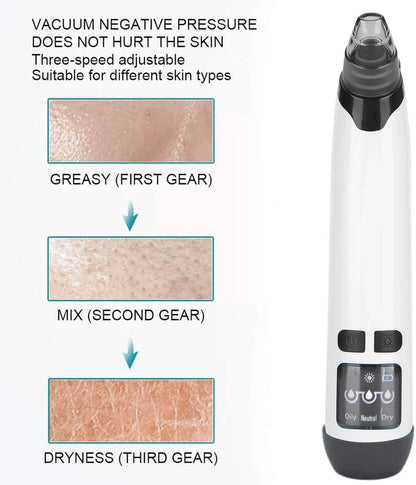 5-in-1 Electric Blackhead Remover Vacuum – Pore Cleaner & Acne Extraction Kit with LCD Display